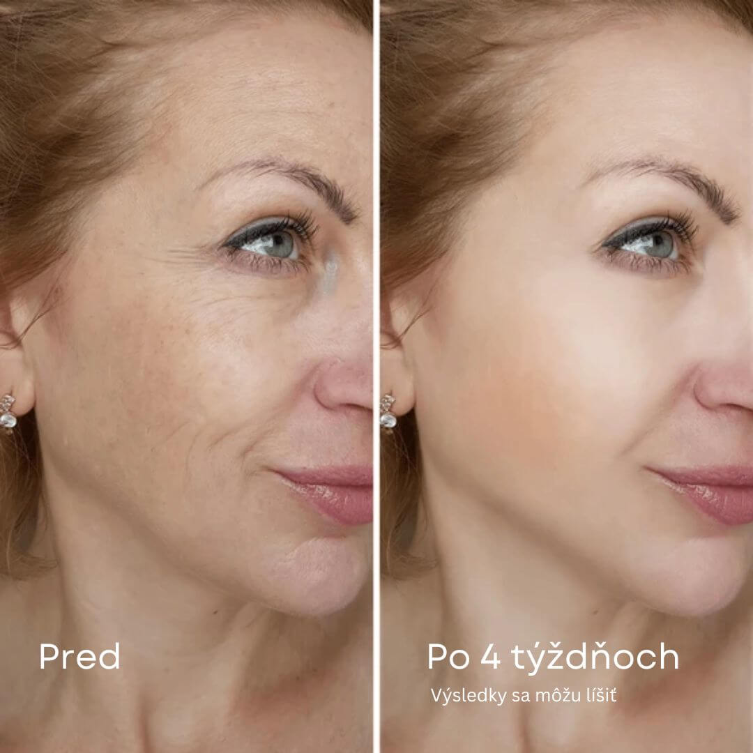 Kolagénová nočná maska GlowPeel™