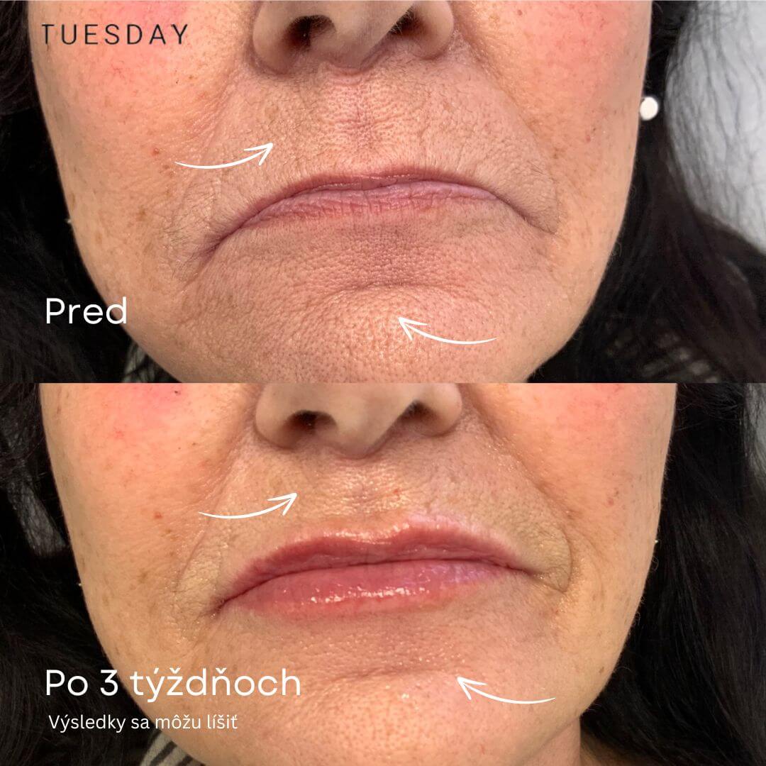 24K zlaté sérum proti starnutiu