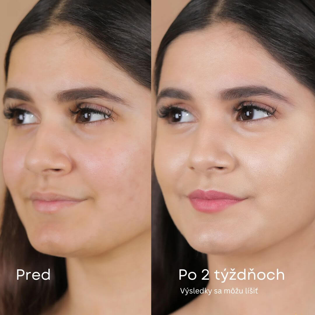 Kolagénová nočná maska GlowPeel™